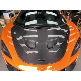 Capota (Carbon) McLaren 540C/570S 2015-2020 foto 2